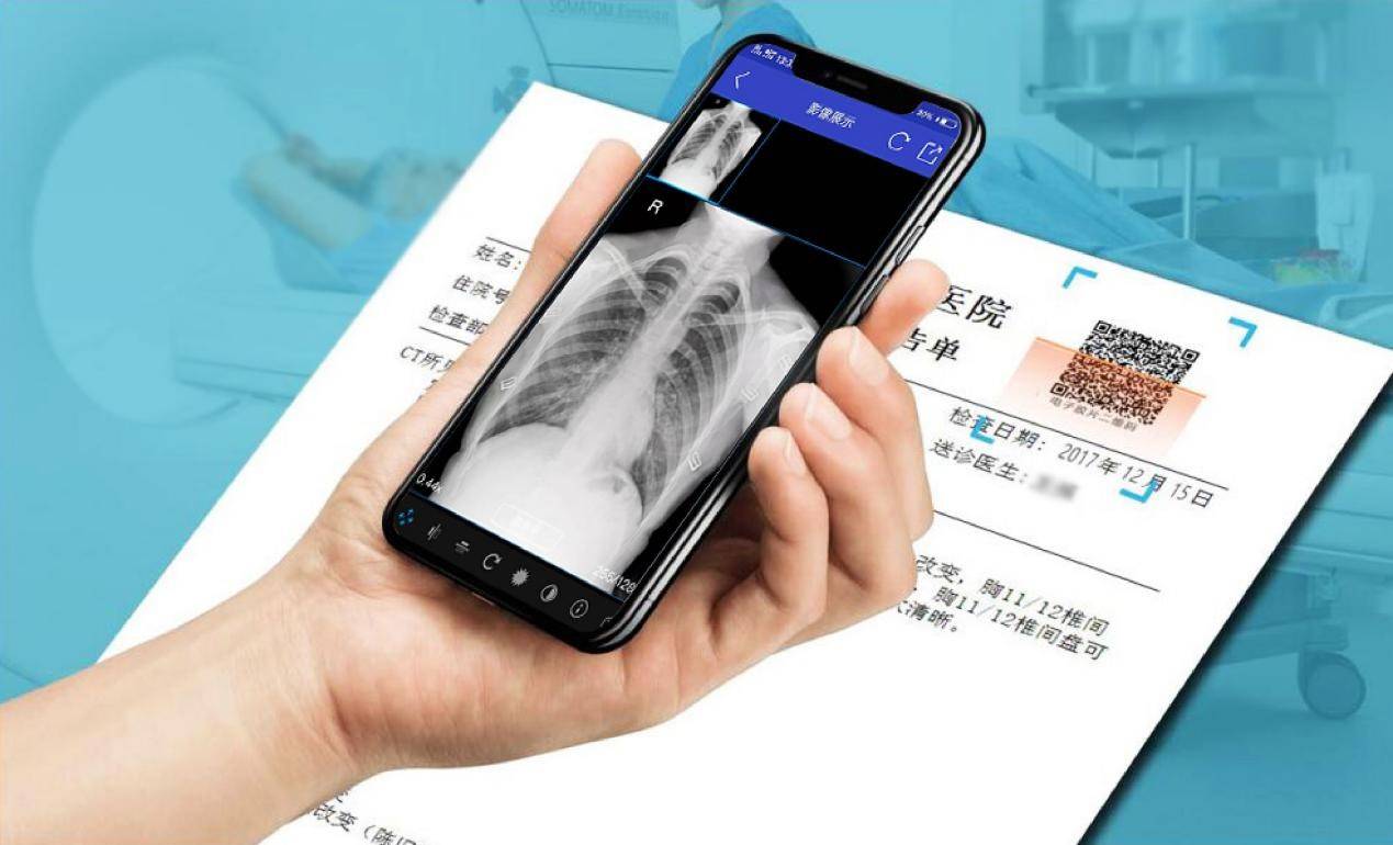 云膠片是什么？